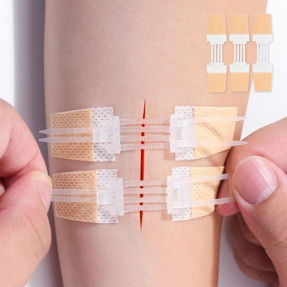 Zipper Tie Wound Closure Patch Hemostatic Patch Wound Fast Suture Zipper Band