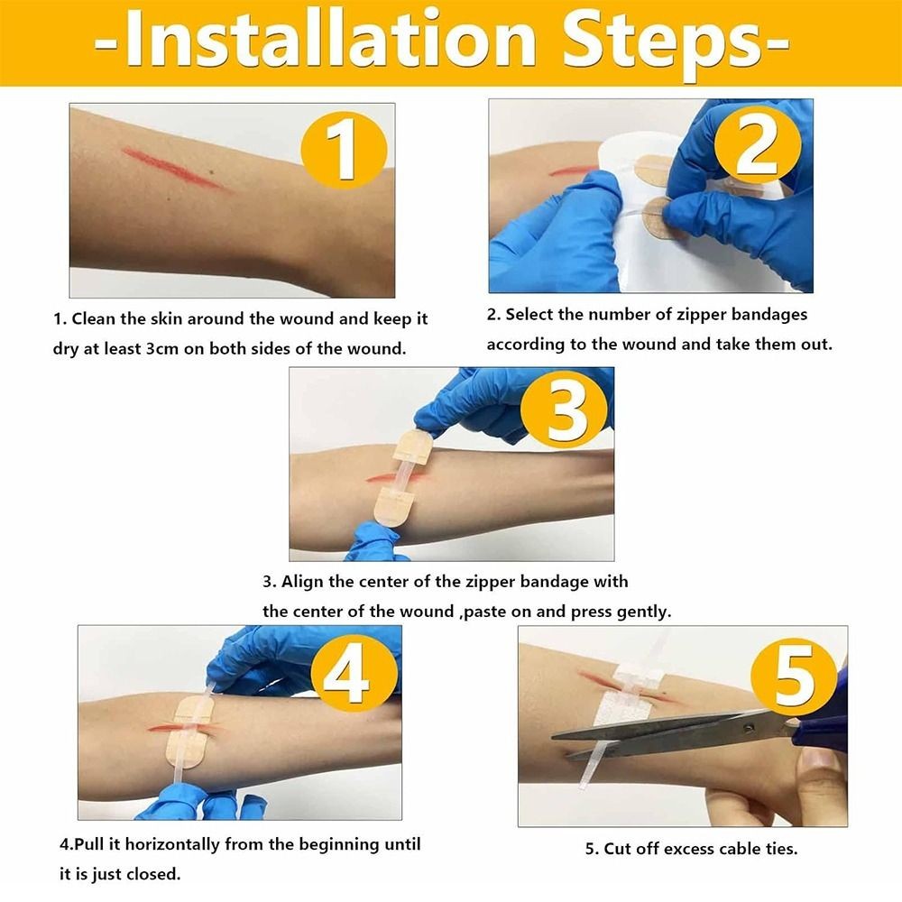 Zipper Tie Wound Closure Patch Hemostatic Patch Wound Fast Suture Zipper Band