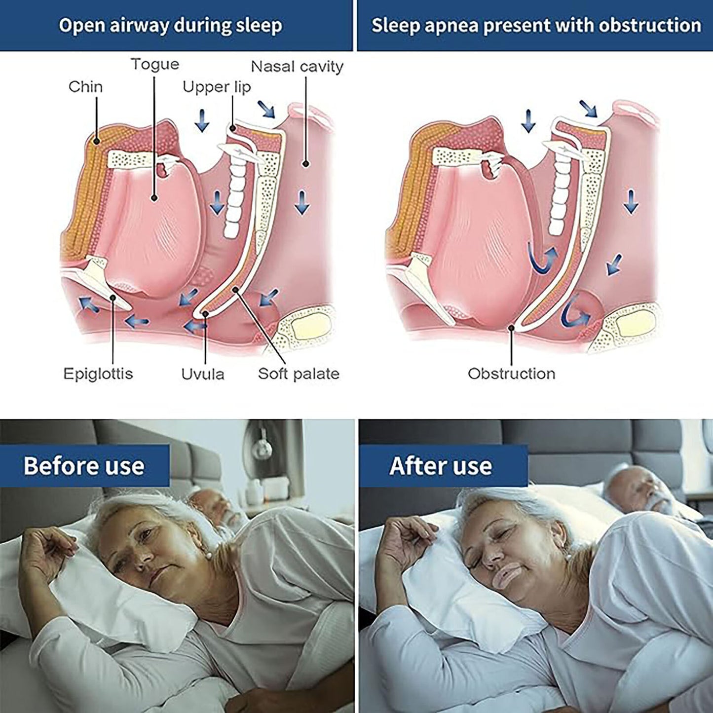 Up 300PCS Strips Gentle Instant Snoring Reliefs Mouth Tape Better Nose Breathing