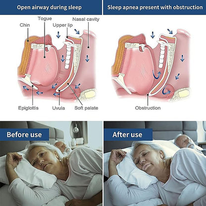 Up 300PCS Strips Gentle Instant Snoring Reliefs Mouth Tape Better Nose Breathing