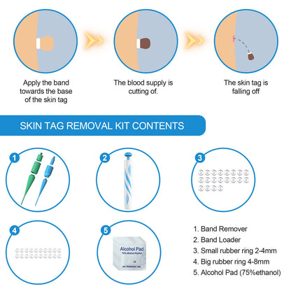 AU Natural Painless Skin Tag Mole Wart Removal Kit Auto SKIN TAG Bands Remover