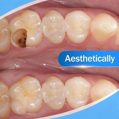 New Dental Cement Cavity Filling Strong Teeth Tooth Repair Restoration Filling