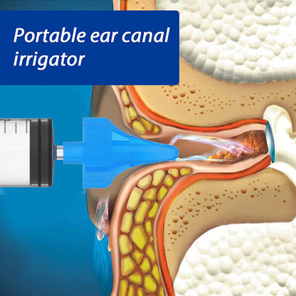 HOT AU Ear Cleaning Irrigation Kit Ear Wax Removal Tool Water Washing Syringe