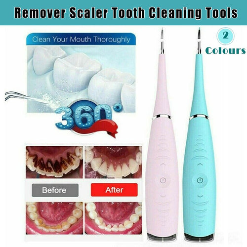 Tooth Stains Tool Dental Scaler Tartar Calculus Plaque Remover Electric Sonic AU