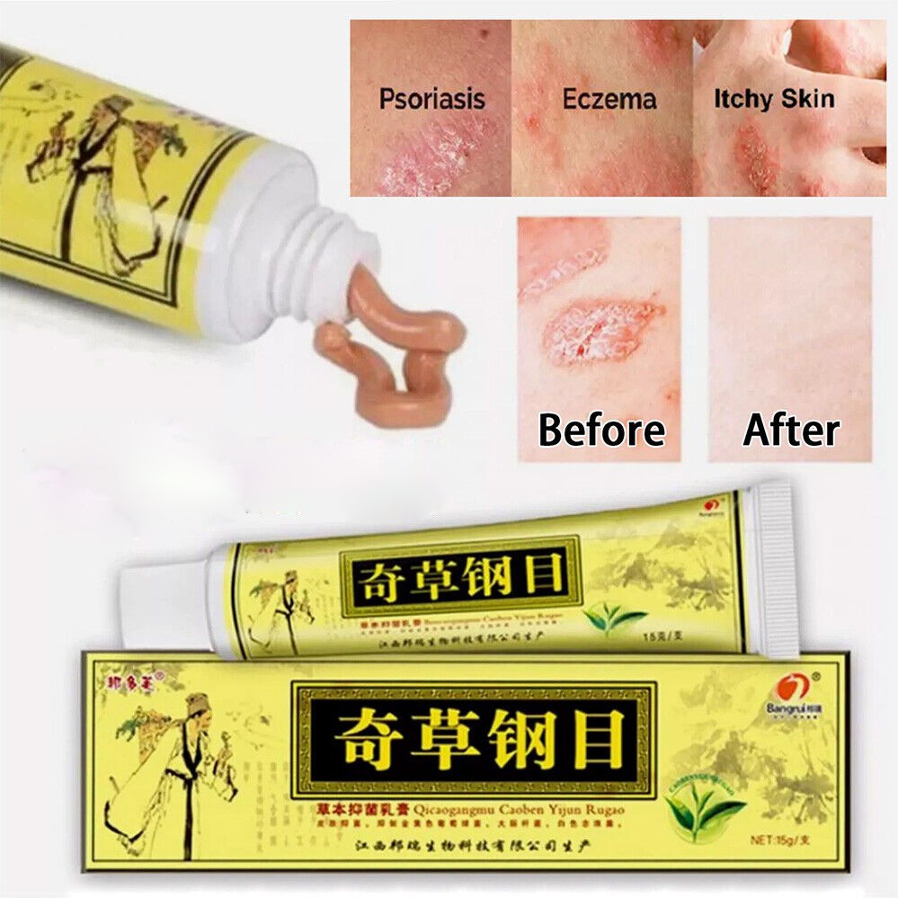 Natural Chinese Herbal Skin Cream Moisturising Ointment Healing Cream Skin Care