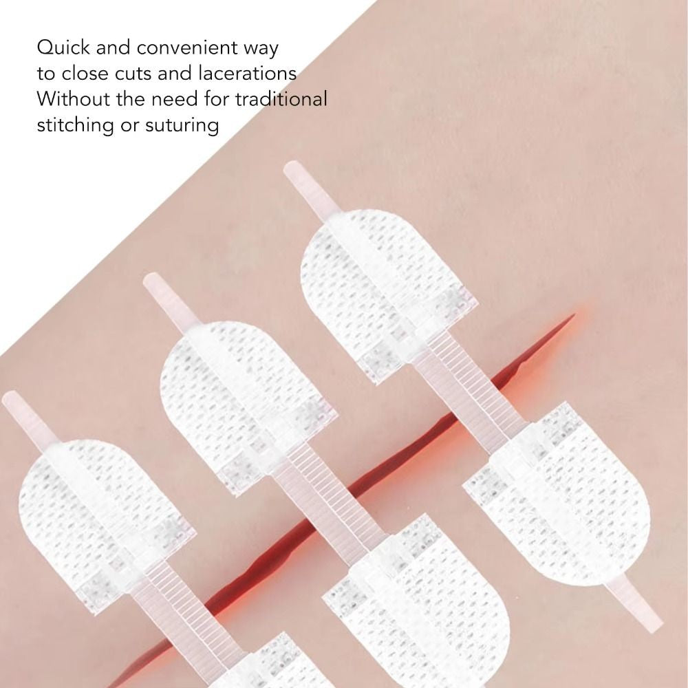 Zipper Tie Wound Closure Patch Hemostatic Patch Wound Fast Suture Zipper Band