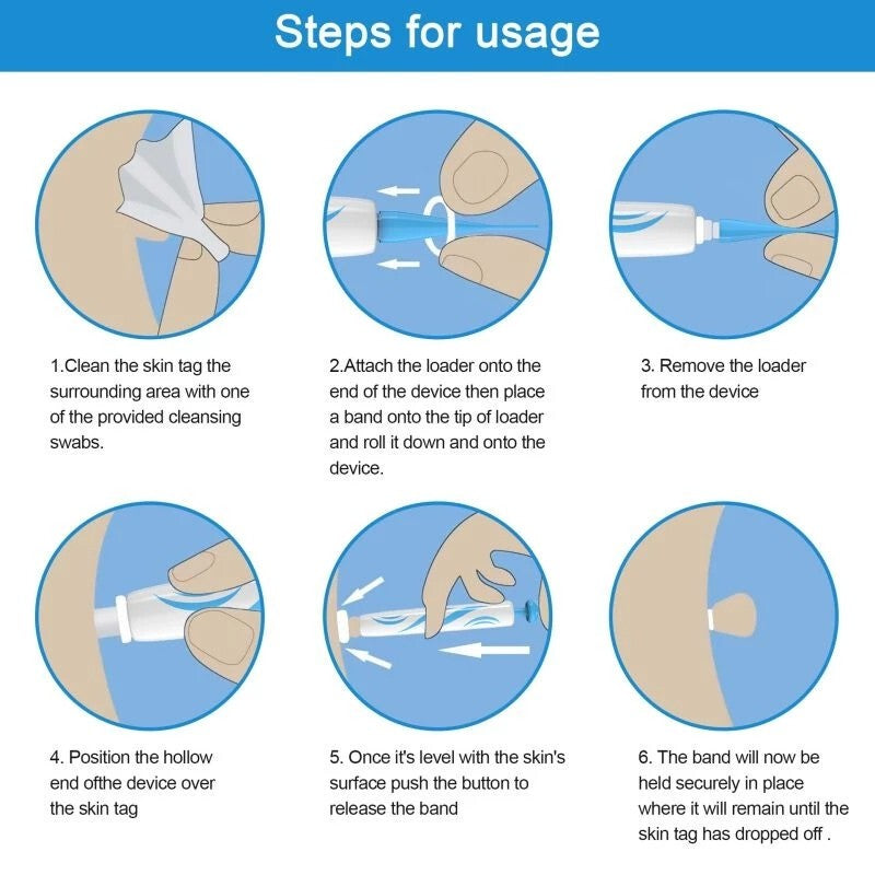 AU Natural Painless Skin Tag Mole Wart Removal Kit Auto SKIN TAG Bands Remover
