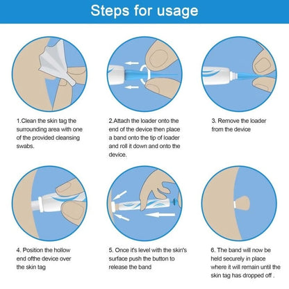 AU Natural Painless Skin Tag Mole Wart Removal Kit Auto SKIN TAG Bands Remover
